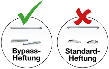 Symbolbild: zeigt den Unterschied zwischen Bypass & Standardheftung